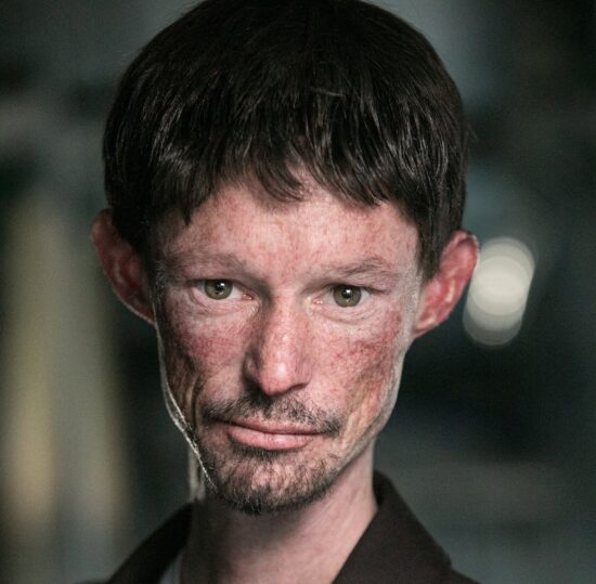 Darren Kent, addio all’attore che recitò in un episodio di GOT: aveva una rara malattia della pelle